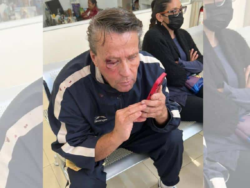 Alfredo Adame con probable desprendimiento de retina tras ser golpeado afuera de su casa